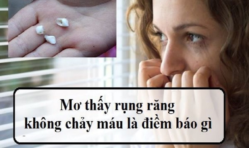 Mơ Thấy Rụng Răng: Giải Mã 15+ Điềm Báo & Hóa Giải Theo Phong Thủy