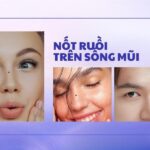 Nốt Ruồi Trên Sống Mũi: Bí Ẩn Vận Mệnh Ẩn Sau Dấu Ấn Nhỏ Bé?